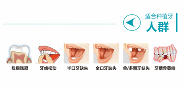 做种植牙适合的人群